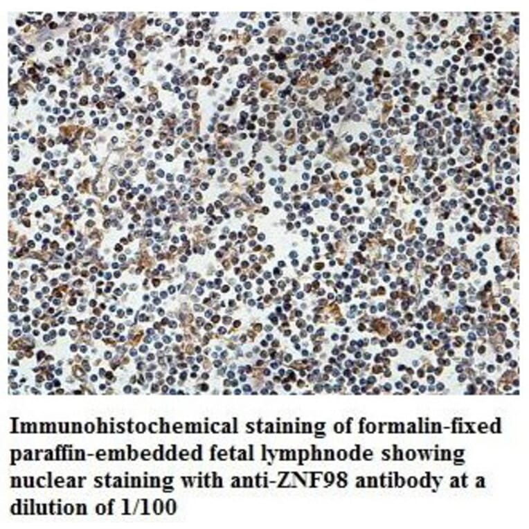 ZNF98 Antibody from Signalway Antibody (39831) - Antibodies.com