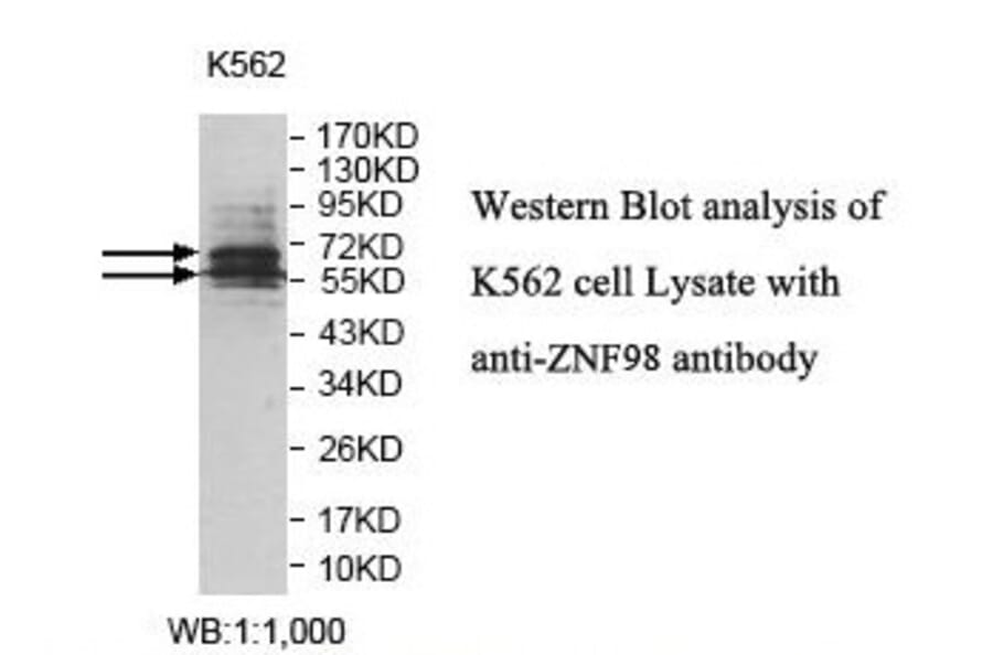 ZNF98 Antibody from Signalway Antibody (39831) - Antibodies.com