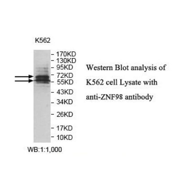ZNF98 Antibody from Signalway Antibody (39831) - Antibodies.com