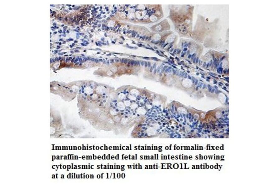 ERO1L Antibody from Signalway Antibody (39835) - Antibodies.com