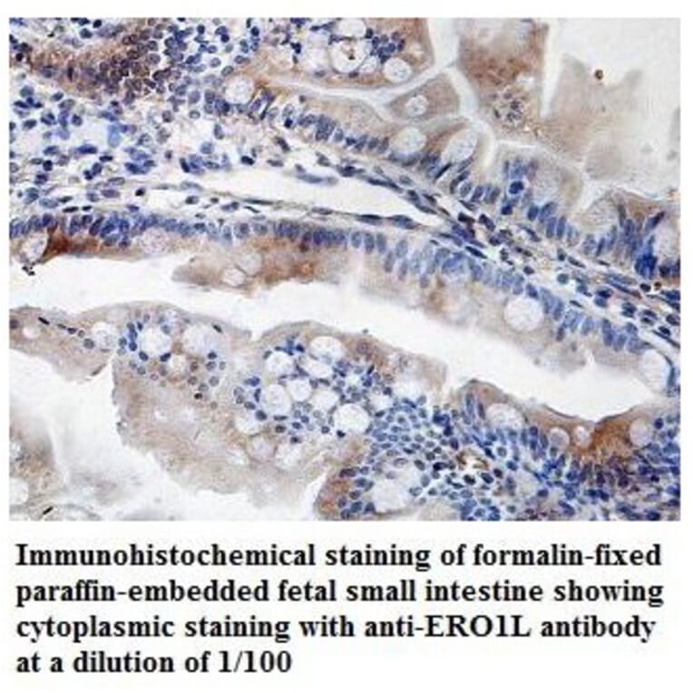 ERO1L Antibody from Signalway Antibody (39835) - Antibodies.com