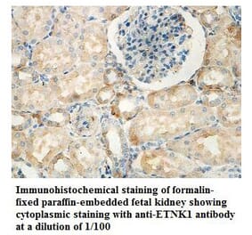 ETNK1 Antibody from Signalway Antibody (39836) - Antibodies.com