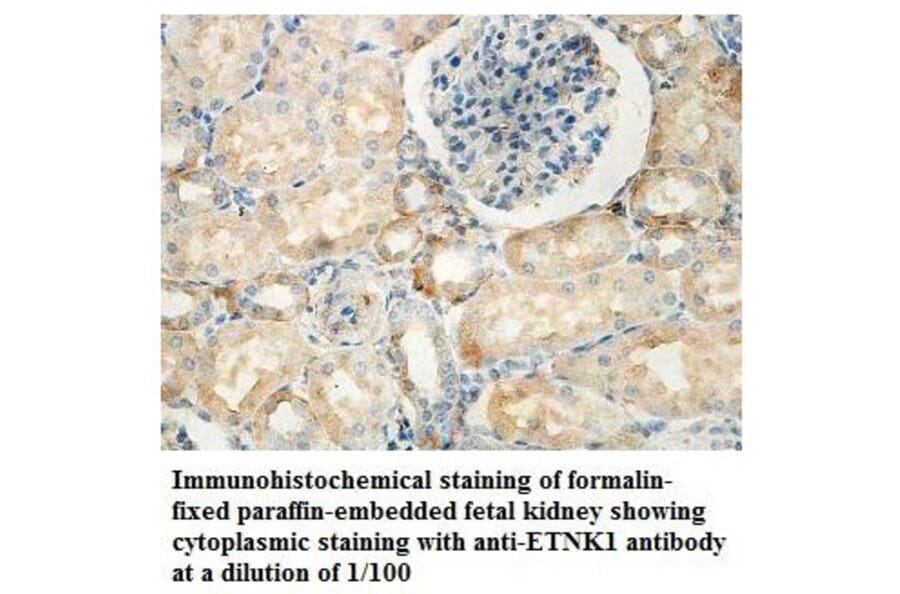 ETNK1 Antibody from Signalway Antibody (39836) - Antibodies.com