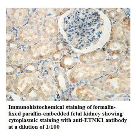 ETNK1 Antibody from Signalway Antibody (39836) - Antibodies.com