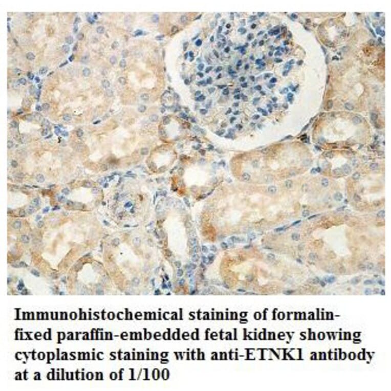 ETNK1 Antibody from Signalway Antibody (39836) - Antibodies.com
