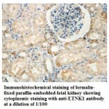 ETNK1 Antibody from Signalway Antibody (39836) - Antibodies.com