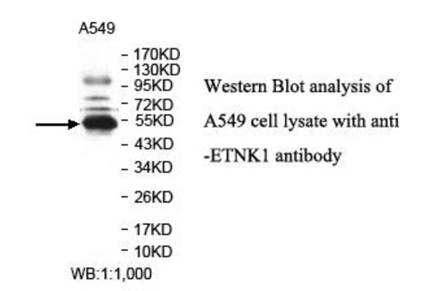 ETNK1 Antibody from Signalway Antibody (39836) - Antibodies.com
