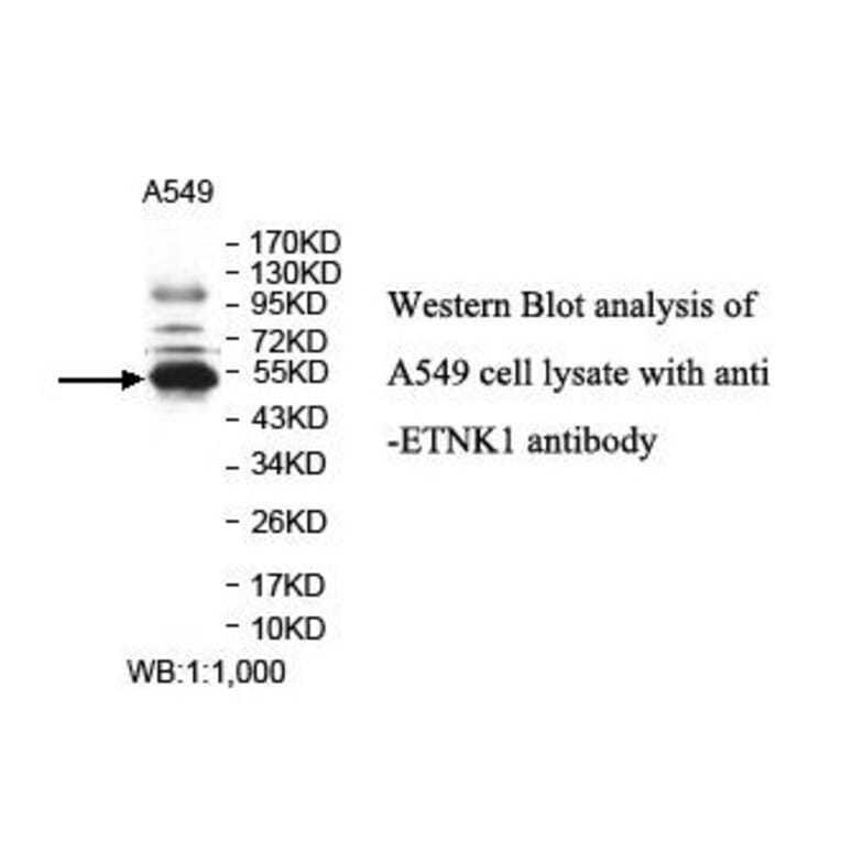ETNK1 Antibody from Signalway Antibody (39836) - Antibodies.com