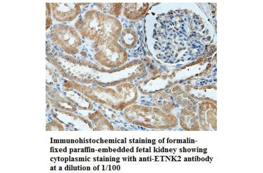 ETNK2 Antibody from Signalway Antibody (39837) - Antibodies.com