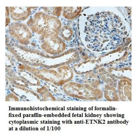 ETNK2 Antibody from Signalway Antibody (39837) - Antibodies.com