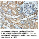 ETNK2 Antibody from Signalway Antibody (39837) - Antibodies.com