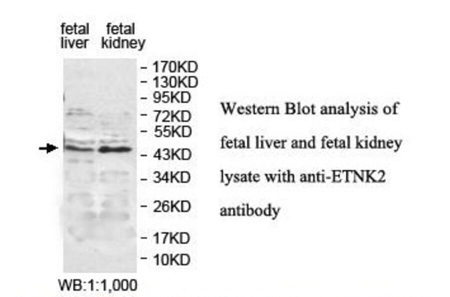 ETNK2 Antibody from Signalway Antibody (39837) - Antibodies.com