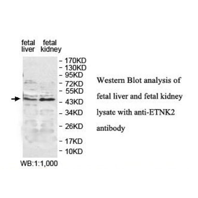 ETNK2 Antibody from Signalway Antibody (39837) - Antibodies.com