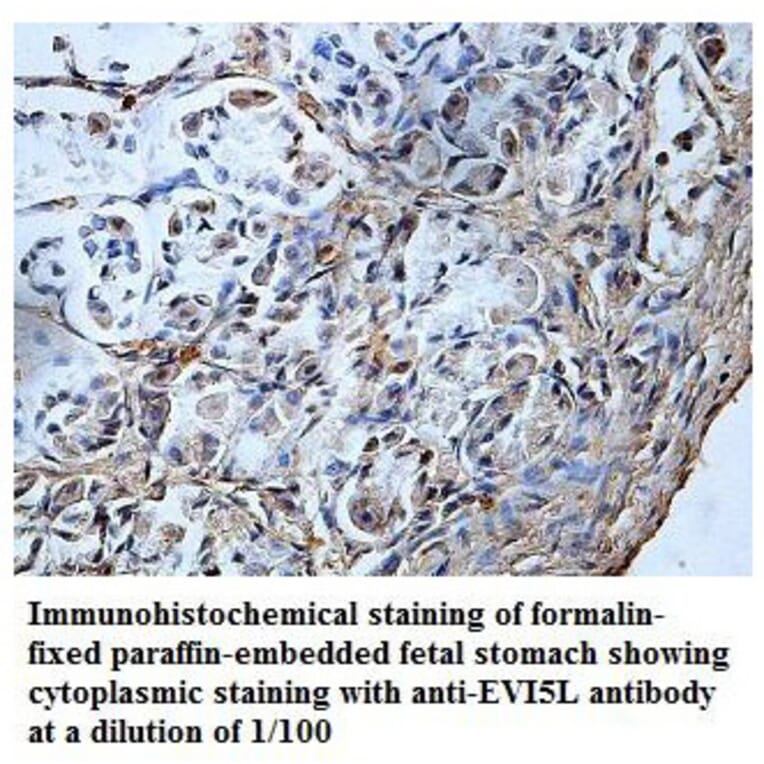 EVI5L Antibody from Signalway Antibody (39838) - Antibodies.com