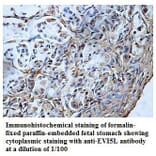 EVI5L Antibody from Signalway Antibody (39838) - Antibodies.com