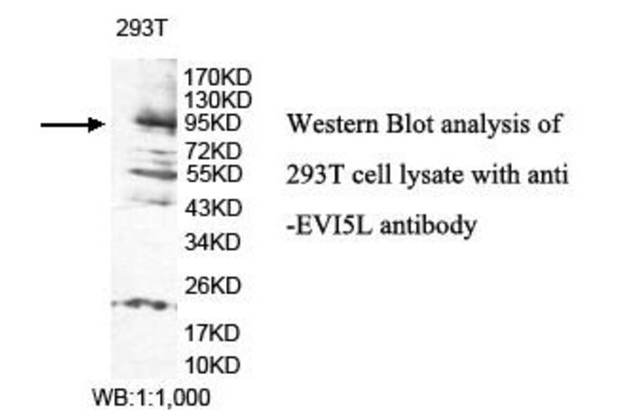 EVI5L Antibody from Signalway Antibody (39838) - Antibodies.com