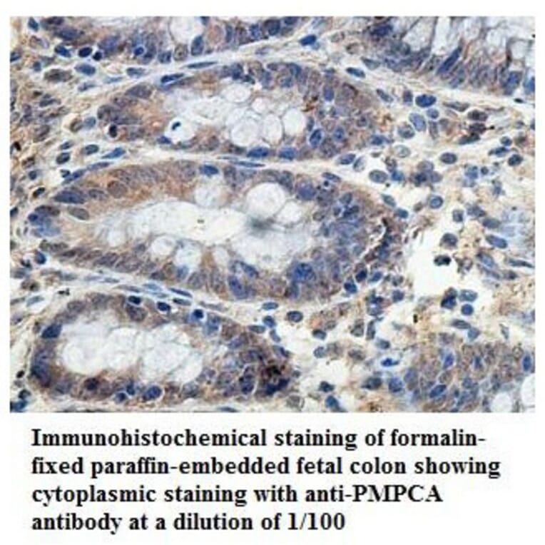 PMPCA Antibody from Signalway Antibody (39839) - Antibodies.com
