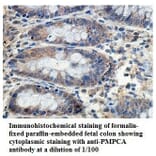 PMPCA Antibody from Signalway Antibody (39839) - Antibodies.com