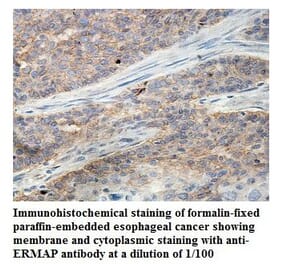 ERMAP Antibody from Signalway Antibody (39845) - Antibodies.com