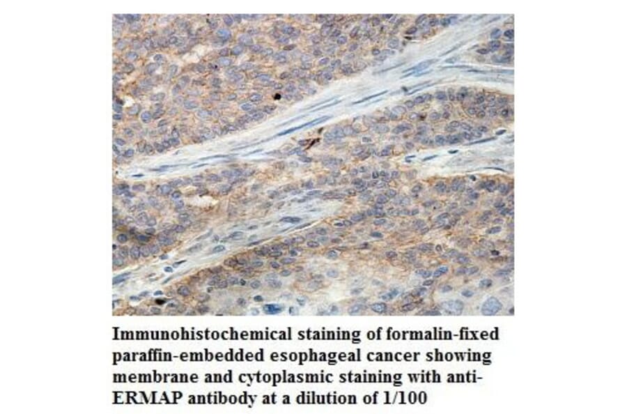 ERMAP Antibody from Signalway Antibody (39845) - Antibodies.com
