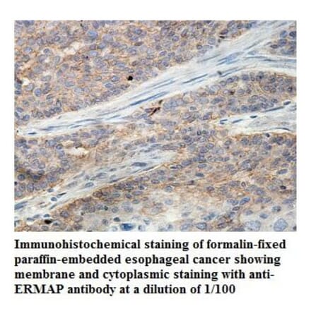 ERMAP Antibody from Signalway Antibody (39845) - Antibodies.com