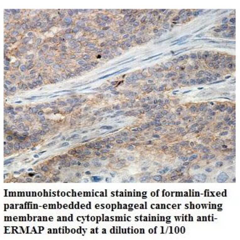 ERMAP Antibody from Signalway Antibody (39845) - Antibodies.com