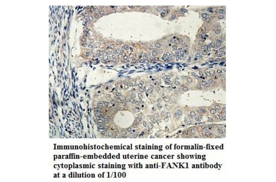 FANK1 Antibody from Signalway Antibody (39853) - Antibodies.com
