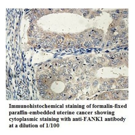 FANK1 Antibody from Signalway Antibody (39853) - Antibodies.com