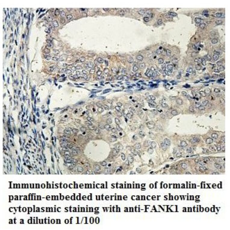 FANK1 Antibody from Signalway Antibody (39853) - Antibodies.com