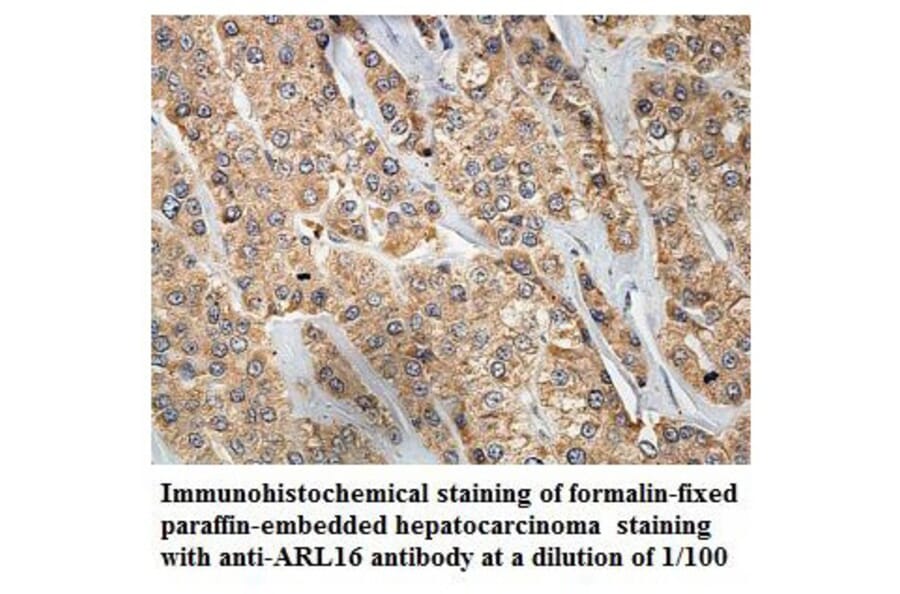 ARL16 Antibody from Signalway Antibody (39855) - Antibodies.com