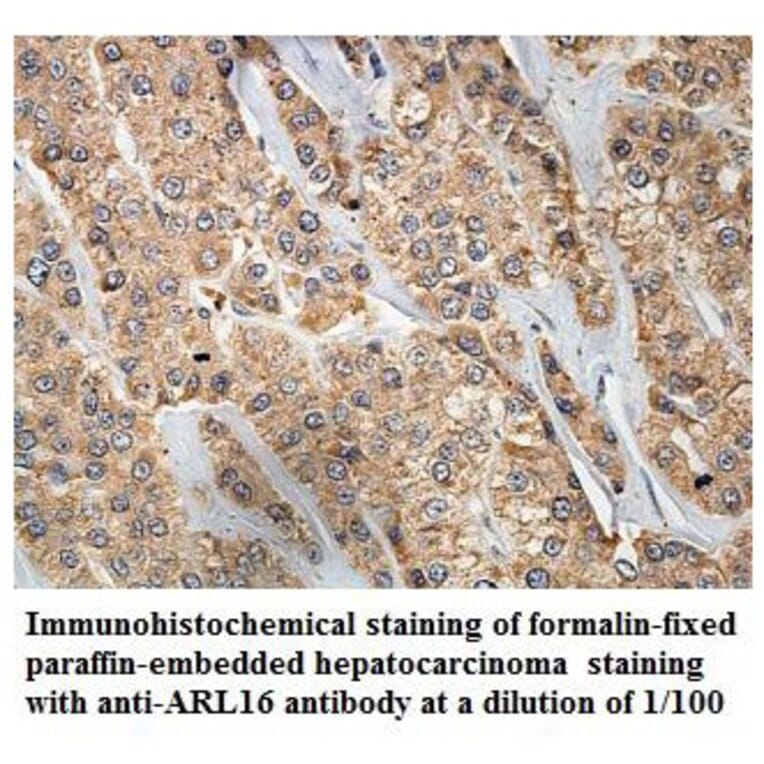 ARL16 Antibody from Signalway Antibody (39855) - Antibodies.com