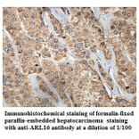 ARL16 Antibody from Signalway Antibody (39855) - Antibodies.com