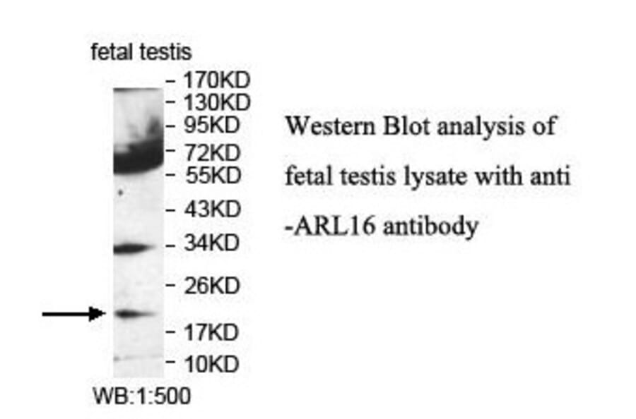 ARL16 Antibody from Signalway Antibody (39855) - Antibodies.com