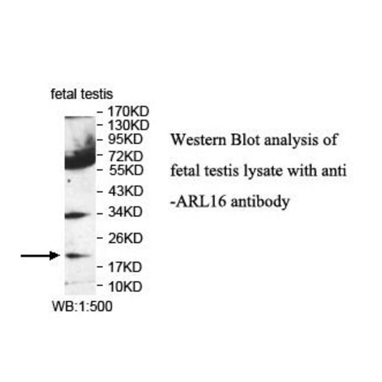 ARL16 Antibody from Signalway Antibody (39855) - Antibodies.com