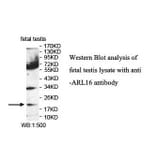 ARL16 Antibody from Signalway Antibody (39855) - Antibodies.com