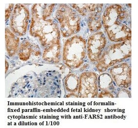 FARS2 Antibody from Signalway Antibody (39857) - Antibodies.com