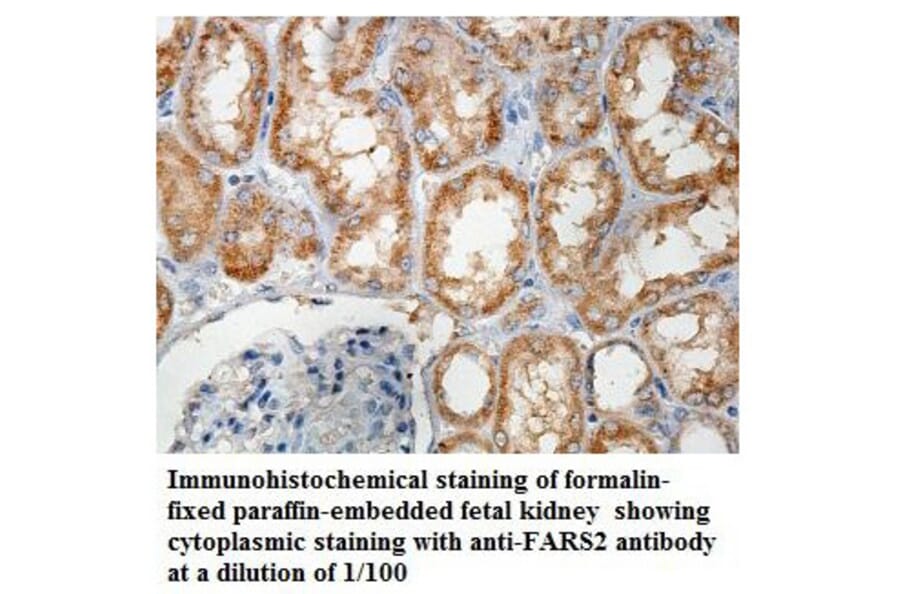 FARS2 Antibody from Signalway Antibody (39857) - Antibodies.com
