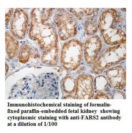 FARS2 Antibody from Signalway Antibody (39857) - Antibodies.com