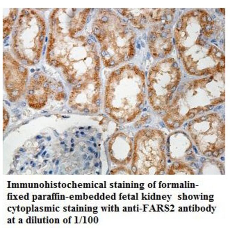 FARS2 Antibody from Signalway Antibody (39857) - Antibodies.com