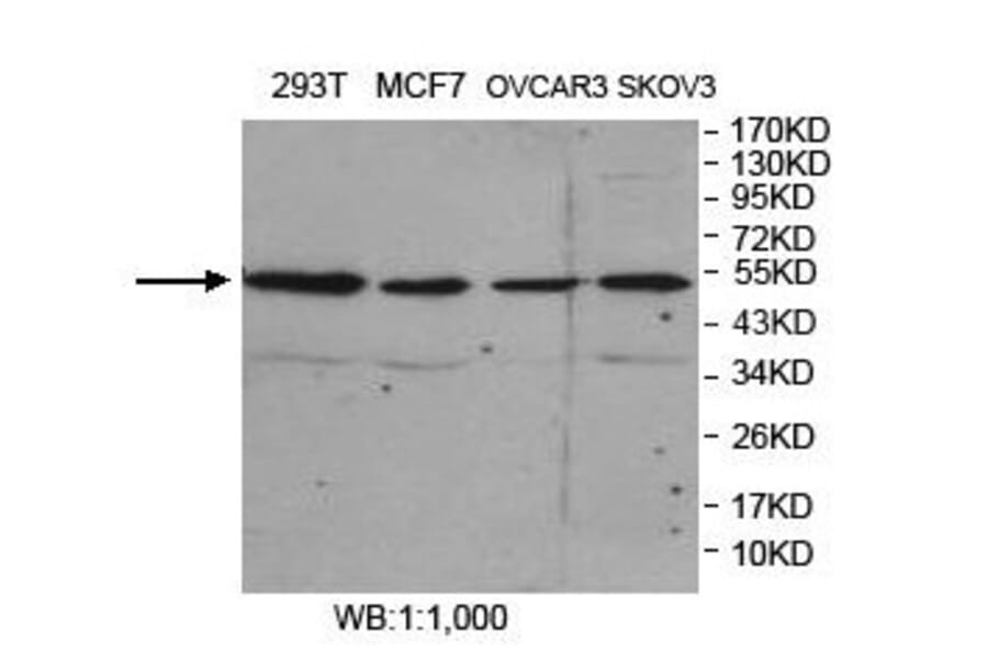FARS2 Antibody from Signalway Antibody (39857) - Antibodies.com