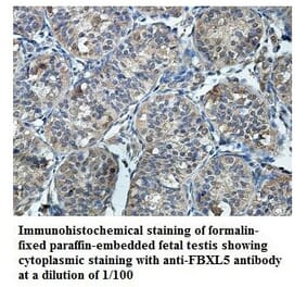 FBXL5 Antibody from Signalway Antibody (39859) - Antibodies.com