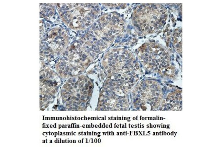 FBXL5 Antibody from Signalway Antibody (39859) - Antibodies.com