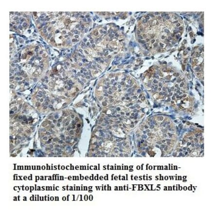 FBXL5 Antibody from Signalway Antibody (39859) - Antibodies.com