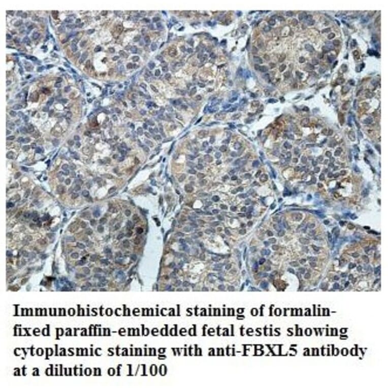 FBXL5 Antibody from Signalway Antibody (39859) - Antibodies.com