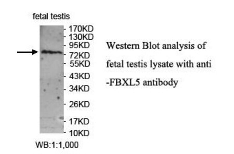 FBXL5 Antibody from Signalway Antibody (39859) - Antibodies.com