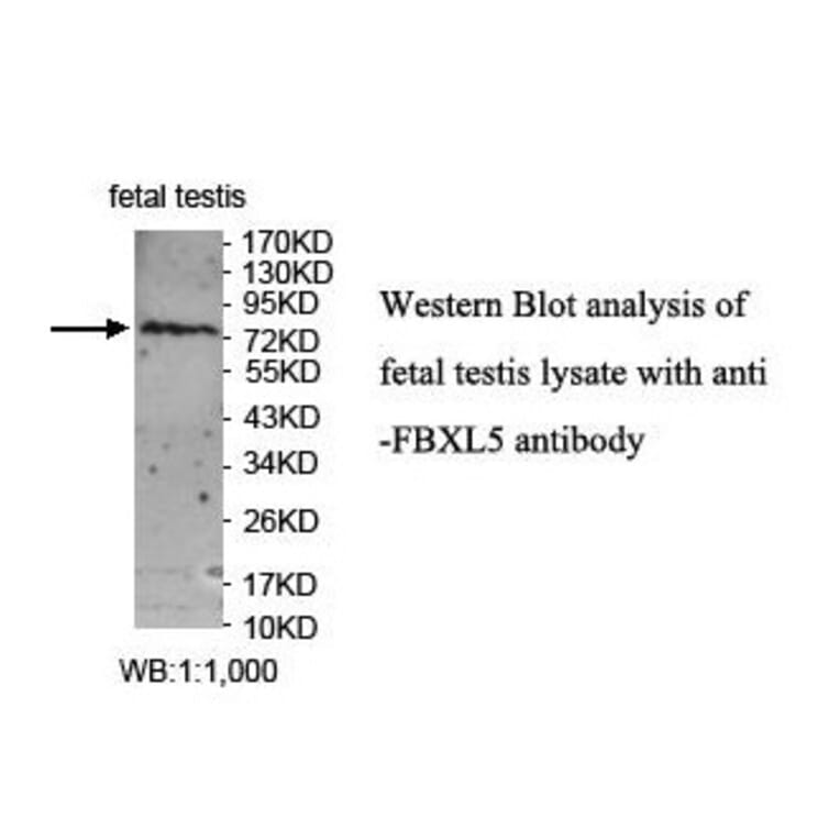 FBXL5 Antibody from Signalway Antibody (39859) - Antibodies.com