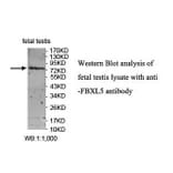 FBXL5 Antibody from Signalway Antibody (39859) - Antibodies.com