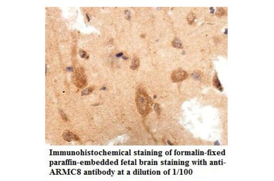 ARMC8 Antibody from Signalway Antibody (39861) - Antibodies.com