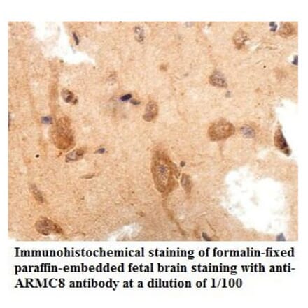 ARMC8 Antibody from Signalway Antibody (39861) - Antibodies.com