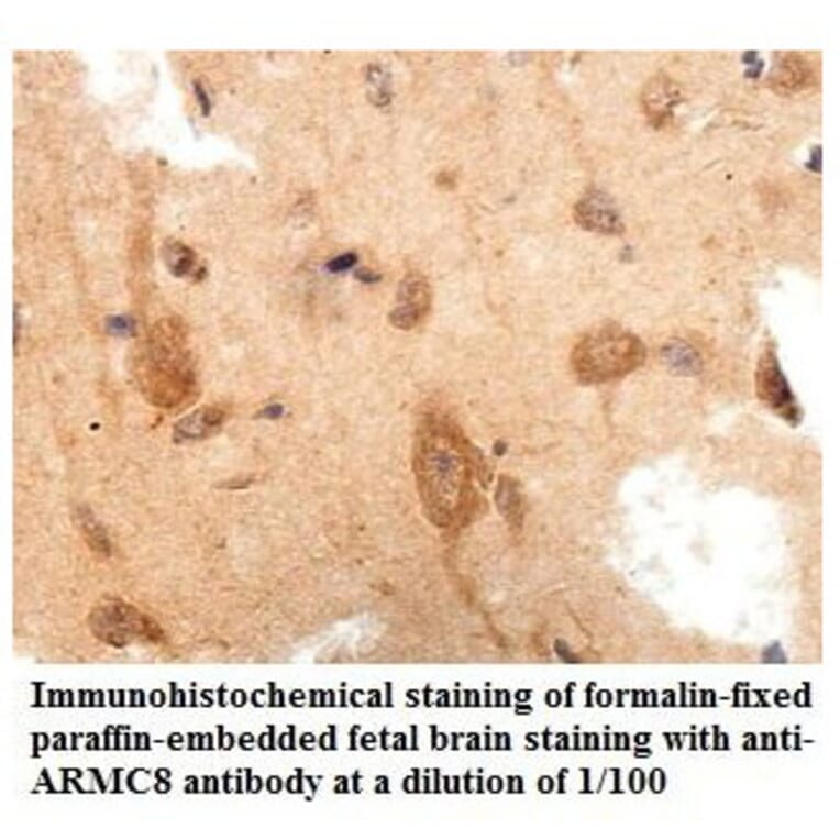 ARMC8 Antibody from Signalway Antibody (39861) - Antibodies.com